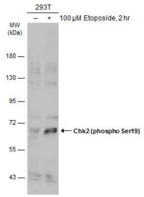 Western Blot: Chk2 [p Ser19] Antibody [NBP3-13328] - Untreated (-) and treated (+) 293T whole cell extracts (30 ug) were separated by 7.5% SDS-PAGE, and the membrane was blotted with Chk2 (phospho Ser19) antibody (NBP3-13328) diluted at 1:500. The HRP-conjugated anti-rabbit IgG antibody (NBP2-19301) was used to detect the primary antibody.